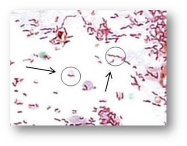 Campylobacter. Taken from: http://www.studyblue.com/notes/note/n/microbio-major-bacterial-genera/deck/7427689