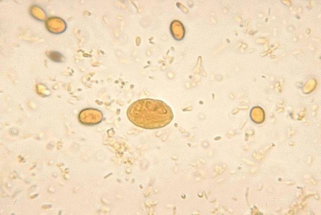 gaird-cyst71362269783743