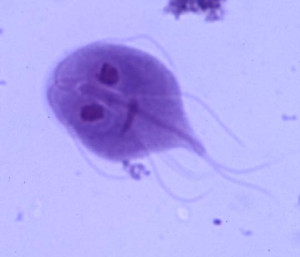 Giardia_Lamblia
