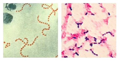 S. pyogenes and S. pneumoniae