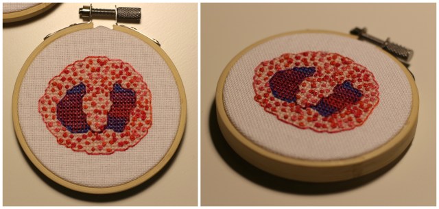 Stitched Eosinophil